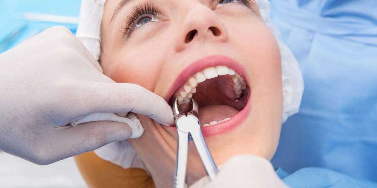 Dentist Noranda: Your Guide to Dental Care in Noranda